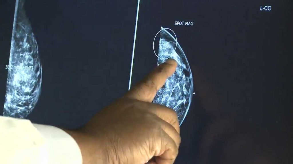 What are Your Chances of Getting Cancer? Getting Cancer
