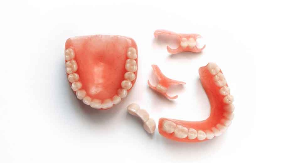 Calgary denture services: understanding care beyond the appliance Calgary denture services