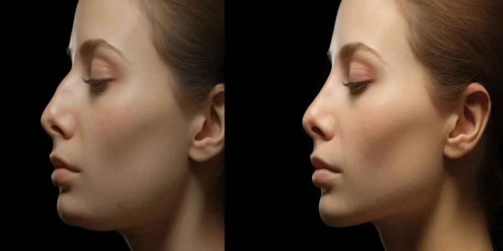 The Evolution of Cosmetic Treatments for Facial Balance